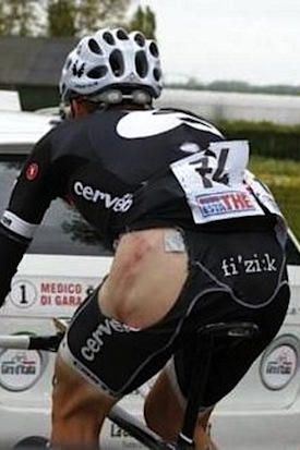 torn bib shorts