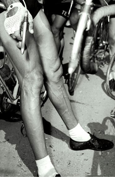 Fausto Coppi's shaved legs