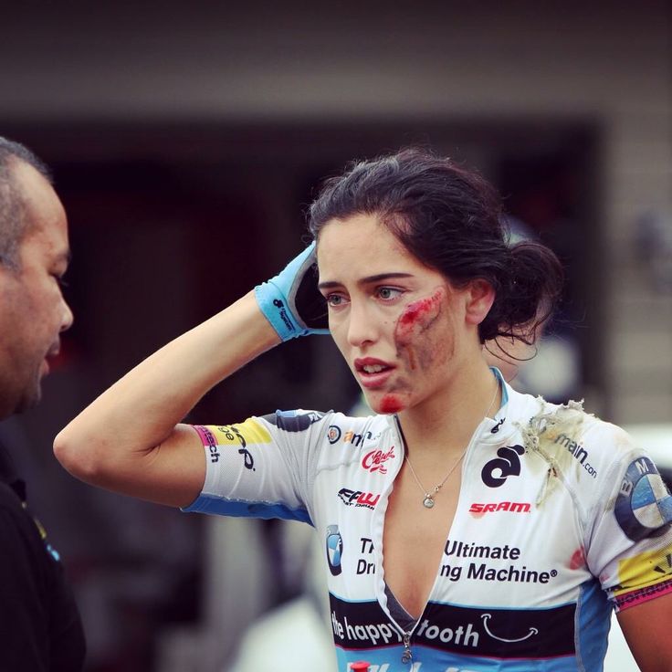 Woman cyclist scrapes and cuts